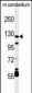 HIF1Alpha Antibody (C-term)