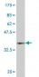 AATF Antibody (monoclonal) (M04)