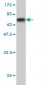 ABHD5 Antibody (monoclonal) (M01)