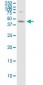 ABHD5 Antibody (monoclonal) (M01)