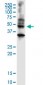 ABHD5 Antibody (monoclonal) (M01)