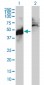 ABHD5 Antibody (monoclonal) (M01)