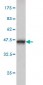 ABHD5 Antibody (monoclonal) (M02)