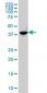 ABHD5 Antibody (monoclonal) (M02)
