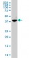 ABHD5 Antibody (monoclonal) (M02)