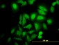 ABL2 Antibody (monoclonal) (M09)