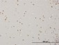 ABL2 Antibody (monoclonal) (M09)