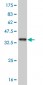ABL2 Antibody (monoclonal) (M09)