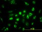 ACAA2 Antibody (monoclonal) (M01)