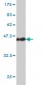 ACAA2 Antibody (monoclonal) (M01)
