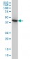 ACAA2 Antibody (monoclonal) (M01)