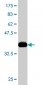 ACAA2 Antibody (monoclonal) (M05)
