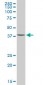 ACAA2 Antibody (monoclonal) (M05)