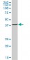 ACAA2 Antibody (monoclonal) (M05)