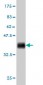 ACACA Antibody (monoclonal) (M01)