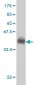 ACADVL Antibody (monoclonal) (M01)
