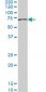 ACADVL Antibody (monoclonal) (M01)