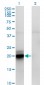 ACATE2 Antibody (monoclonal) (M01)