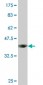 ACO1 Antibody (monoclonal) (M01)