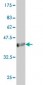 ACOX2 Antibody (monoclonal) (M01)