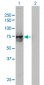 ACOX2 Antibody (monoclonal) (M01)