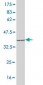 ACSL1 Antibody (monoclonal) (M02)