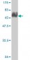 ACTA2 Antibody (monoclonal) (M02)