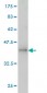 ACTN1 Antibody (monoclonal) (M01)