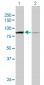 ACTN1 Antibody (monoclonal) (M01)