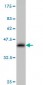 ACTN4 Antibody (monoclonal) (M01)