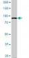 ACTN4 Antibody (monoclonal) (M01)