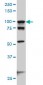 ACTN4 Antibody (monoclonal) (M01)