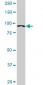 ACTN4 Antibody (monoclonal) (M01)