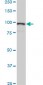 ACTN4 Antibody (monoclonal) (M01)