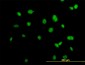 ACTN4 Antibody (monoclonal) (M01)