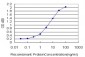 ACTN4 Antibody (monoclonal) (M01)