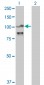 ACTN4 Antibody (monoclonal) (M01)