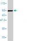 ACY1 Antibody (monoclonal) (M01)