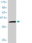 ACYP1 Antibody (monoclonal) (M01)
