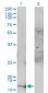 ACYP1 Antibody (monoclonal) (M01)