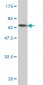 ADA Antibody (monoclonal) (M01)