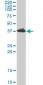 ADA Antibody (monoclonal) (M01)