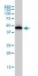 ADA Antibody (monoclonal) (M01)