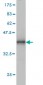 ADAM12 Antibody (monoclonal) (M01)