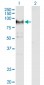 ADAM12 Antibody (monoclonal) (M01)