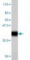 ADAM2 Antibody (monoclonal) (M01)
