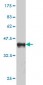 ADAM9 Antibody (monoclonal) (M01)