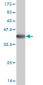 ADAMTS17 Antibody (monoclonal) (M01)