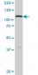 ADAMTS17 Antibody (monoclonal) (M01)