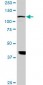 ADAMTS17 Antibody (monoclonal) (M01)